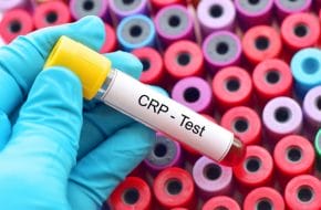 🔒 CRP-Kinetik sagt das Immuntherapieansprechen beim metastasierten Nierenzell- und Urothelkarzinom voraus