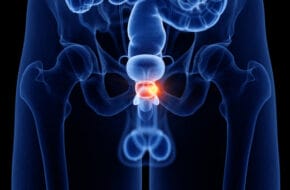 Metformin als Therapieansatz bei metastasierendem Prostatakrebs
